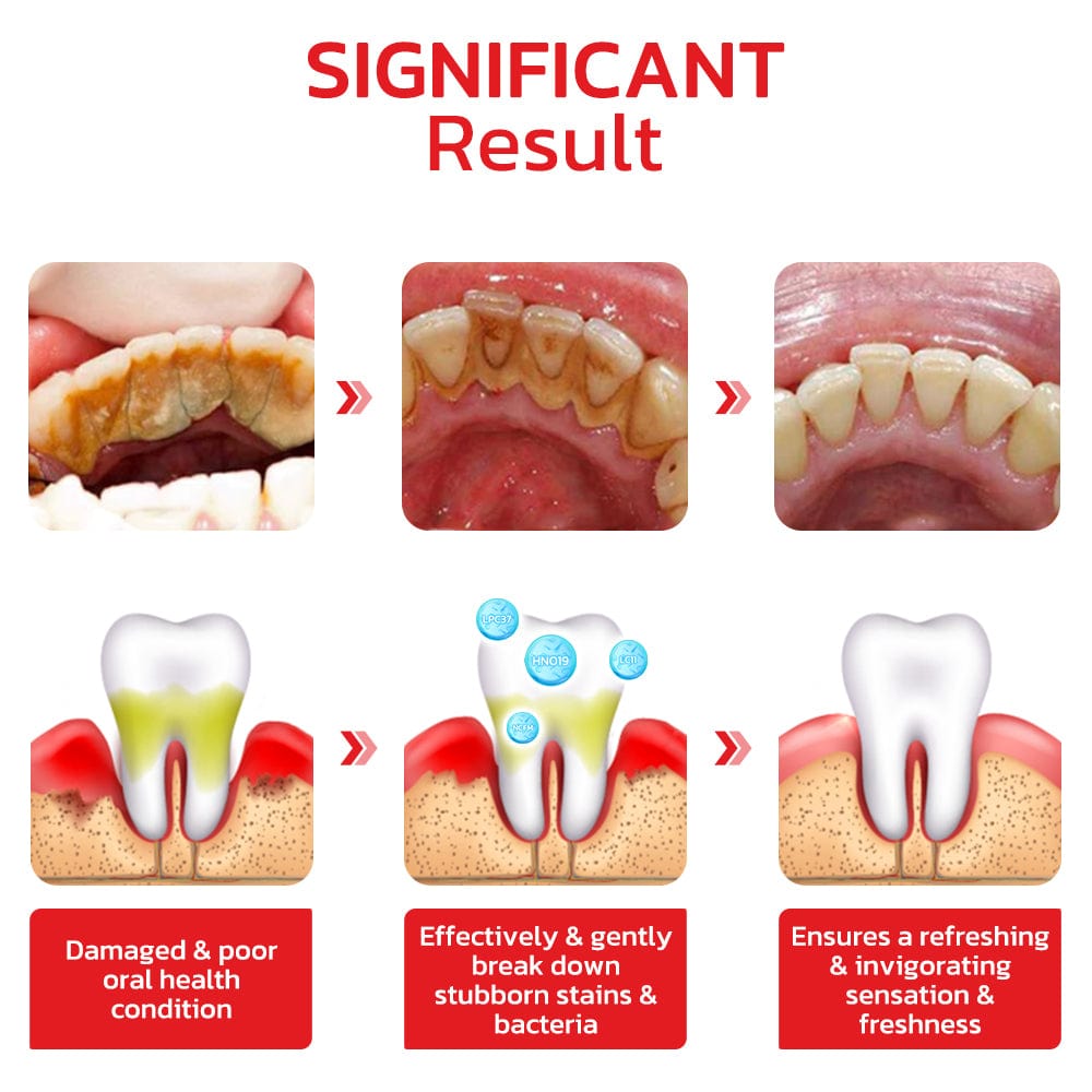SP-4® Ultra Teeth Whitening Toothpaste