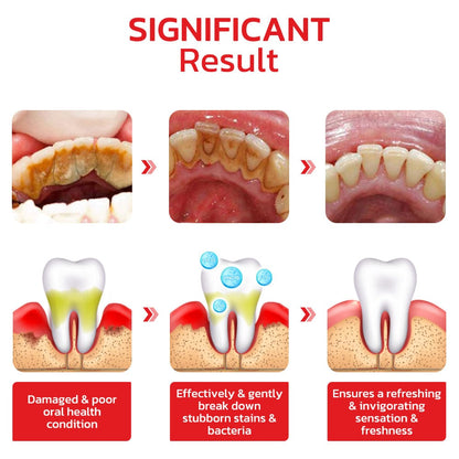 SP-4® Ultra Teeth Whitening Toothpaste