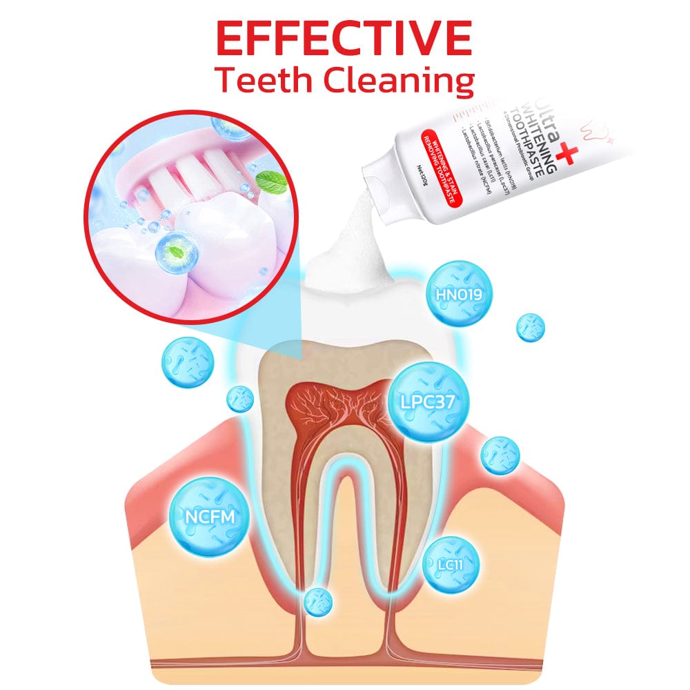 SP-4® Ultra Teeth Whitening Toothpaste
