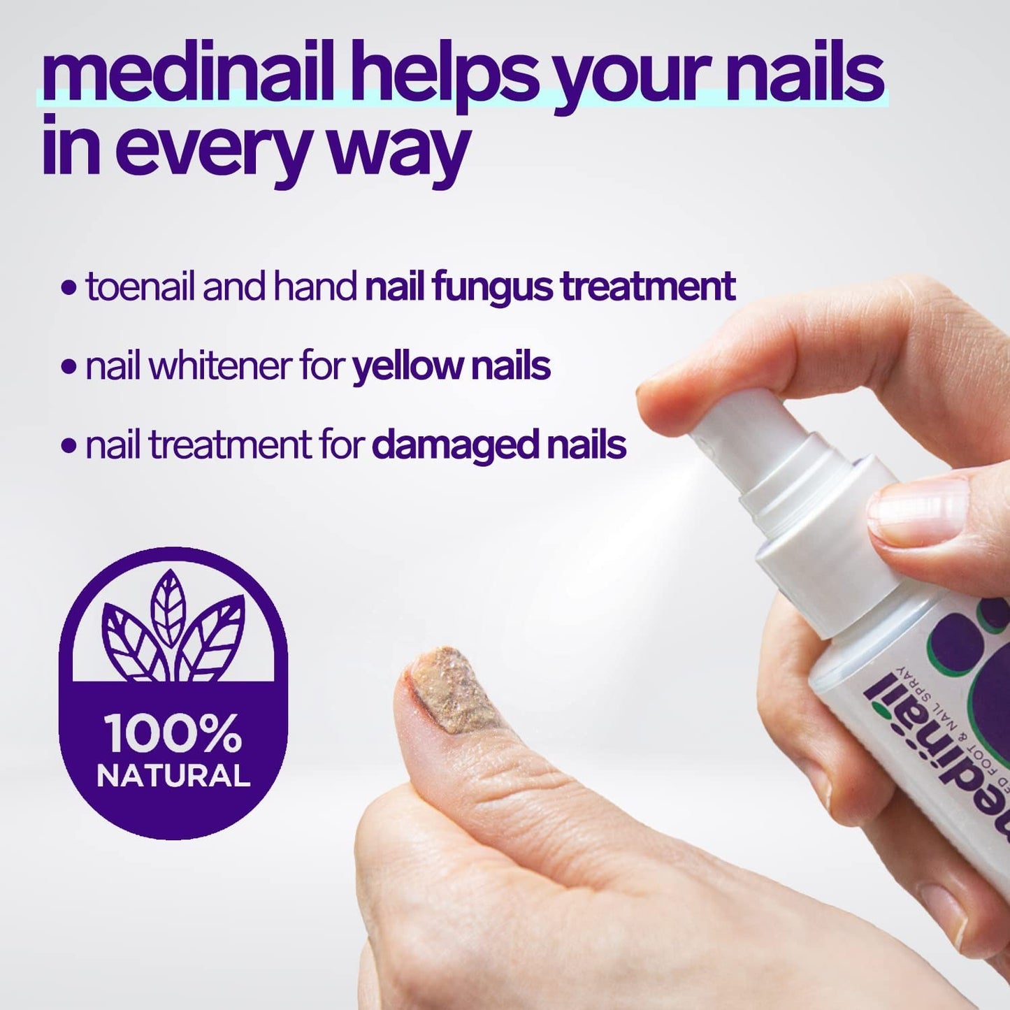 Jaysuing® - Magic Nail Fungus Spray