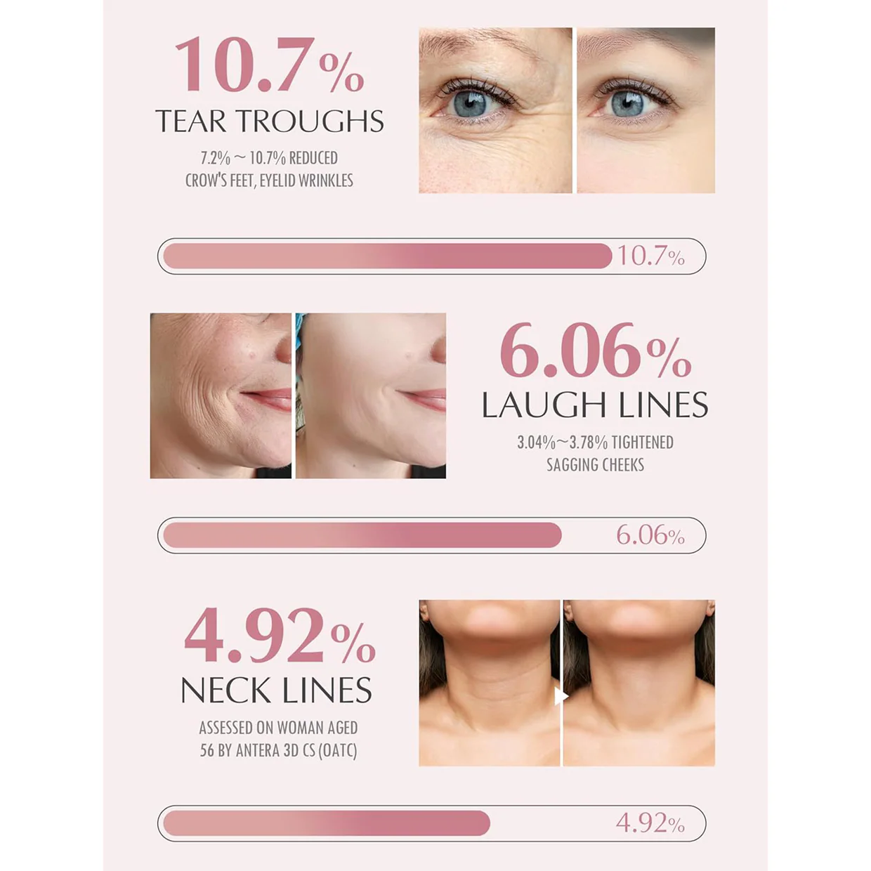 Agerase® - Magic Lutein Firming and Anti-Wrinkle Balm