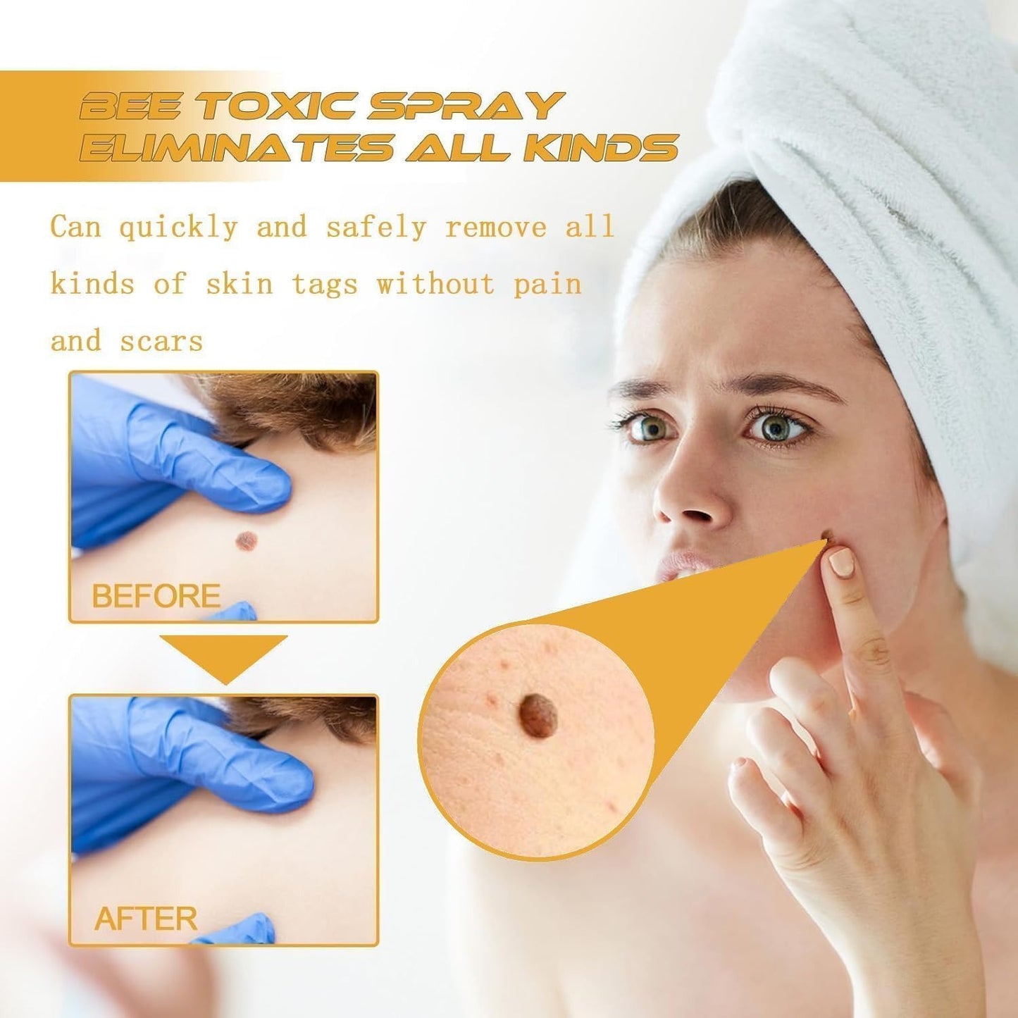 TagAway® - Painless Bee Venom Skin Tag & Mole Remover