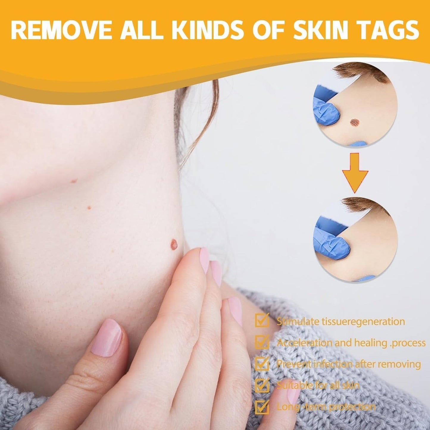 TagAway® - Painless Bee Venom Skin Tag & Mole Remover
