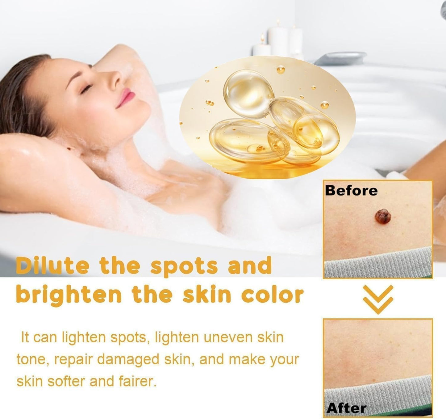 TagAway® - Painless Bee Venom Skin Tag & Mole Remover