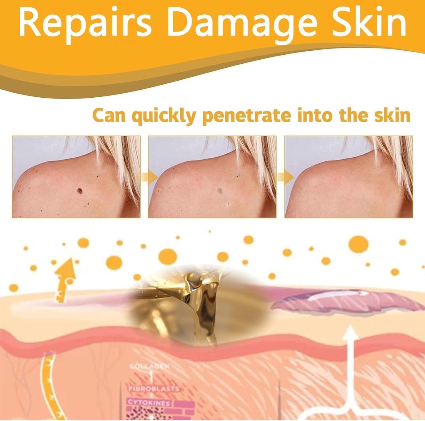 TagAway® - Painless Bee Venom Skin Tag & Mole Remover