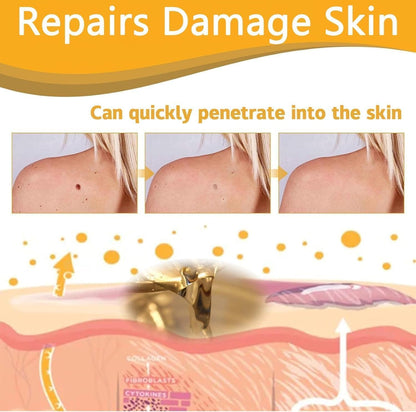 TagAway® - Painless Bee Venom Skin Tag & Mole Remover